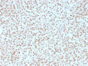 AKT1 Antibody - IHC testing of FFPE human pancreas with AKT1 antibody (clone AKT1/2491). HIER: boil tissue sections in pH6, 10mM citrate buffer, for 10-20 min followed by cooling at RT for 20 min.