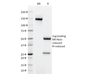 AKT1 Antibody - SDS-PAGE analysis of purified, BSA-free AKT1 antibody (clone AKT1/2491) as confirmation of integrity and purity.