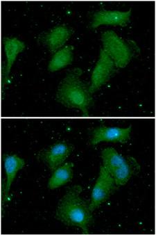 AKT1 Antibody - ICC/IF analysis of AKT1/3 in A549 cells. The cell was stained with AKT1/3 antibody (1:100).The secondary antibody (green) was used Alexa Fluor 488. DAPI was stained the cell nucleus (blue).