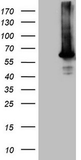 AKT1 Antibody - HEK293T cells were transfected with the pCMV6-ENTRY control. (Left lane) or pCMV6-ENTRY AKT1. (Right lane) cDNA for 48 hrs and lysed. Equivalent amounts of cell lysates. (5 ug per lane) were separated by SDS-PAGE and immunoblotted with anti-AKT1.