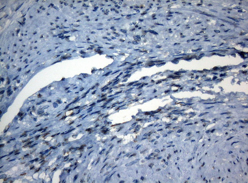 AKT1 Antibody - Immunohistochemical staining of paraffin-embedded Human endometrium tissue within the normal limits using anti-AKT1 mouse monoclonal antibody. (Heat-induced epitope retrieval by 1mM EDTA in 10mM Tris buffer. (pH8.5) at 120°C for 3 min. (1:150)