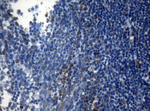 AKT1 Antibody - Immunohistochemical staining of paraffin-embedded Human tonsil within the normal limits using anti-AKT1 mouse monoclonal antibody. (Heat-induced epitope retrieval by 1mM EDTA in 10mM Tris buffer. (pH8.5) at 120°C for 3 min. (1:150)