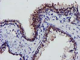 AKT1 Antibody - IHC of paraffin-embedded Human prostate tissue using anti-AKT1 mouse monoclonal antibody.