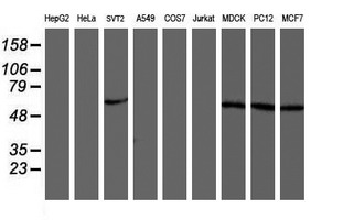 AKT1 Antibody - Western blot of extracts (35 ug) from 9 different cell lines by using anti-AKT1 monoclonal antibody.