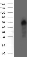 AKT1 Antibody - HEK293T cells were transfected with the pCMV6-ENTRY control (Left lane) or pCMV6-ENTRY AKT1 (Right lane) cDNA for 48 hrs and lysed. Equivalent amounts of cell lysates (5 ug per lane) were separated by SDS-PAGE and immunoblotted with anti-AKT1.