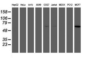 AKT1 Antibody - Western blot of extracts (35ug) from 9 different cell lines by using anti-AKT1 monoclonal antibody.