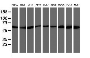 AKT1 Antibody - Western blot of extracts (35 ug) from 9 different cell lines by using anti-AKT1 monoclonal antibody.