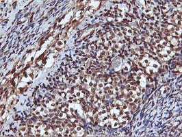 AKT1 Antibody - IHC of paraffin-embedded Human Ovary tissue using anti-AKT1 mouse monoclonal antibody.