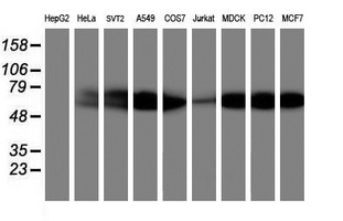 AKT1 Antibody - Western blot of extracts (35ug) from 9 different cell lines by using anti-AKT1 monoclonal antibody.