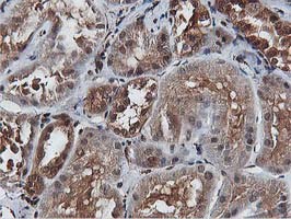 AKT1 Antibody - IHC of paraffin-embedded Human Kidney tissue using anti-AKT1 mouse monoclonal antibody. (Heat-induced epitope retrieval by 10mM citric buffer, pH6.0, 100C for 10min).