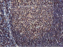 AKT1 Antibody - IHC of paraffin-embedded Human tonsil using anti-AKT1 mouse monoclonal antibody. (Heat-induced epitope retrieval by 10mM citric buffer, pH6.0, 100C for 10min).