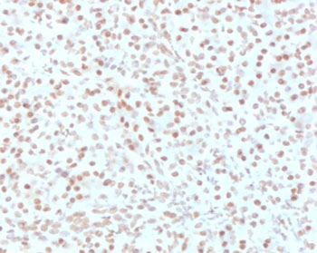 AKT1 Antibody - IHC testing of FFPE human pancreas with AKT1 antibody (clone RASTPK-1). HIER: boil tissue sections in pH6, 10mM citrate buffer, for 10-20 min followed by cooling at RT for 20 min.