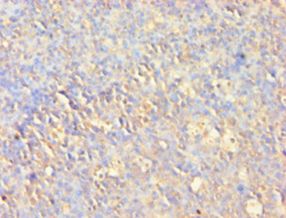 AKT1 Antibody - Immunohistochemistry of paraffin-embedded human tonsil tissue using CSB-PA15905A0Rb at 1:100 dilution.  This image was taken for the unconjugated form of this product. Other forms have not been tested.