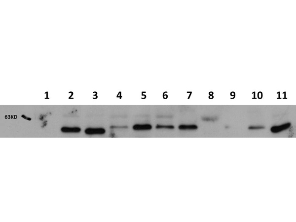 AKT1 Antibody - Western Blot of Mouse anti-AKT1 antibody. Lane 1: AKT1 Null. Lane 2: WT. Lane 3: MEF #1. Lane 4 : A549. Lane 5: Calu-1. Lane 6: PC-3. Lane 7: HepG2. Lane 8: Jurkat. Lane 9: SKOV3. Lane 10: 293T. Lane 11: C2C12. Load: 20 ug per lane. Primary antibody: AKT1 antibody at 1:1,000 for overnight at 4°C. Secondary antibody: Peroxidase Rabbit secondary antibody at 1:40,000 for 30 min at RT. Block: MB-070 for 30 min at RT. Predicted/Observed size: 56 kDa for AKT1. Other band(s): none.
