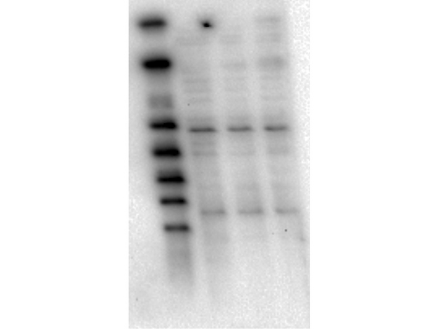 AKT1 Antibody - Western Blot of Mouse Anti-AKT1 antibody. Lane 1: LnCap lysate Lane 2: Jurkat lysate. Lane 3: MDA-MB 468 lysate. Load: 5 µg per lane. Primary antibody: AKT1 unconjugated antibody at 1:1000 for overnight at 4°C. Secondary antibody: Mouse secondary antibody at 1:20,000 for 45 min at RT. Block: 5% BLOTTO overnight at 4°C. Predicted/Observed size: 56 kDa for AKT1.