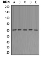AKT1 Antibody - Western blot analysis of AKT1 expression in K562 (A); HepG2 (B); NIH3T3 (C); mouse spleen (D); H9C2 (E) whole cell lysates.