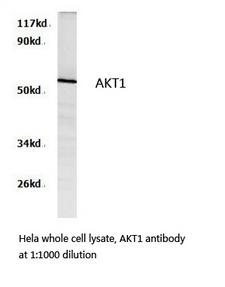 AKT1 Antibody - Western blot of AKT pAb in extracts from HeLa cells, rat brain tissues and raw264.7 cells.