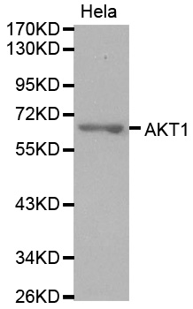 AKT1 Antibody - Western blot analysis of extracts of HeLa cells.