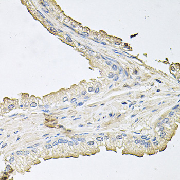 AKT1 Antibody - Immunohistochemistry of paraffin-embedded human prostate tissue.