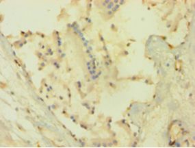 AKT1 Antibody - Immunohistochemistry of paraffin-embedded human prostate tissue using CSB-PA15905A0Rb at 1:100 dilution.  This image was taken for the unconjugated form of this product. Other forms have not been tested.