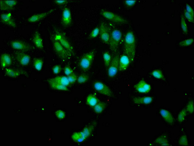 AKT1 Antibody - Immunofluorescence staining of Hela cells with AKT1 Antibody at 1:200, counter-stained with DAPI. The cells were fixed in 4% formaldehyde, permeabilized using 0.2% Triton X-100 and blocked in 10% normal Goat Serum. The cells were then incubated with the antibody overnight at 4°C. The secondary antibody was Alexa Fluor 488-congugated AffiniPure Goat Anti-Rabbit IgG(H+L).