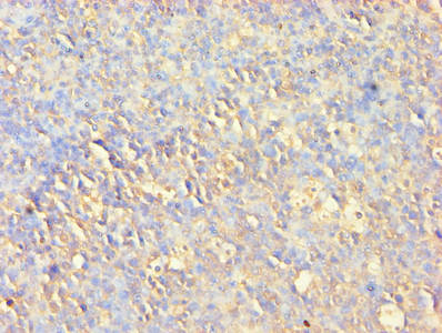 AKT1 Antibody - Immunohistochemistry of paraffin-embedded human tonsil tissue using AKT1 Antibody at dilution of 1:100