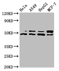 AKT1 Antibody - Western Blot Positive WB detected in: Hela whole cell lysate, A549 whole cell lysate, HepG2 whole cell lysate, MCF-7 whole cell lysate All lanes: AKT1 antibody at 7.4µg/ml Secondary Goat polyclonal to rabbit IgG at 1/50000 dilution Predicted band size: 56, 49 kDa Observed band size: 56, 49 kDa