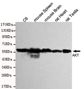 AKT1 Antibody - Western blot detection of total AKT in rat heart, rat testis, mouse brain, mouse spleen and C6 cell lysates and using AKT(pan) mouse monoclonal antibody (1:1000 dilution). Predicted band size: 60KDa. Observed band size: 60KDa.