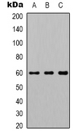 AKT1 Antibody - Western blot analysis of AKT1 expression in HeLa (A); NIH3T3 (B); PC12 (C) whole cell lysates.