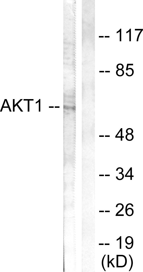 AKT1 Antibody - Western blot of extracts from 293 cells, treated with EGF (200ng/ml, 30mins), using Akt (Ab-308) antibody.