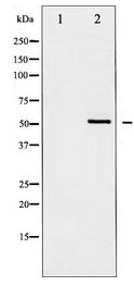 AKT1 Antibody - Western blot of Akt expression in Serum treated HUVEC whole cell lysates,The lane on the left is treated with the antigen-specific peptide.