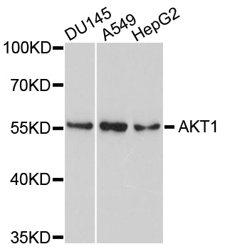 AKT1 Antibody - Western blot analysis of extracts of various cell lines, using AKT1 antibody at 1:1000 dilution. The secondary antibody used was an HRP Goat Anti-Mouse IgG (H+L) at 1:10000 dilution. Lysates were loaded 25ug per lane and 3% nonfat dry milk in TBST was used for blocking. An ECL Kit was used for detection and the exposure time was 90s.