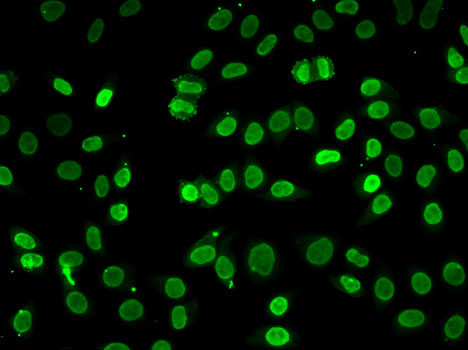 AKT1 Antibody - Immunofluorescence analysis of HeLa cells using AKT1 antibody.