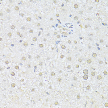 AKT1 Antibody - Immunohistochemistry of paraffin-embedded rat liver using AKT1 antibody at dilution of 1:100 (40x lens).