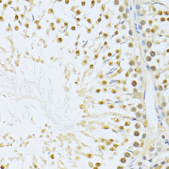 AKT1 Antibody - Immunohistochemistry of paraffin-embedded rat testis using AKT1 antibody at dilution of 1:100 (40x lens).