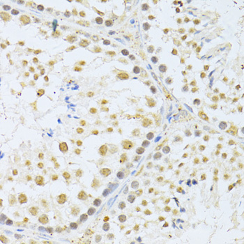 AKT1 Antibody - Immunohistochemistry of paraffin-embedded mouse testis using AKT1 antibody at dilution of 1:100 (40x lens).