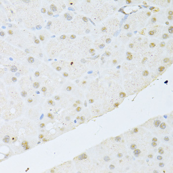 AKT1 Antibody - Immunohistochemistry of paraffin-embedded mouse pancreas using AKT1 antibody at dilution of 1:100 (40x lens).