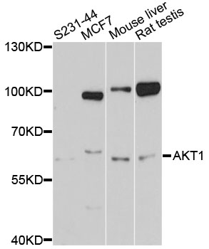 AKT1 Antibody - Western blot analysis of extracts of various cell lines, using AKT1 antibody at 1:1000 dilution. The secondary antibody used was an HRP Goat Anti-Rabbit IgG (H+L) at 1:10000 dilution. Lysates were loaded 25ug per lane and 3% nonfat dry milk in TBST was used for blocking. An ECL Kit was used for detection and the exposure time was 60s.