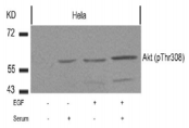 AKT1 Antibody - Detection of Akt (phospho-Thr308) in extracts of HeLa cells untreated or treated with EGF, serum or both.