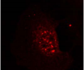 AKT1 Antibody - Detection of Akt (phospho-Thr308) in methanol-fixed HeLa cells showing nuclear dot staining.