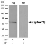 AKT1 Antibody - Detection of Akt (phosphoSer473) in extracts of 293 cells untreated or treated with EGF or calf intestinal phosphatase.