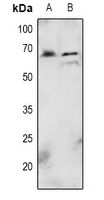 AKT1 Antibody - Western blot analysis of AKT (pT72) expression in HepG2 (A), Hela (B) whole cell lysates.
