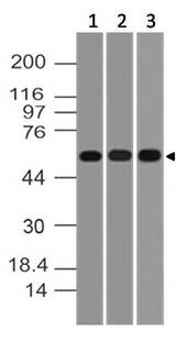 AKT1 Antibody - Fig-1: Western blot analysis of AKT1. Anti-AKT1 antibody was tested at 2 µg/ml on SKBR3, PC3 and BT474.