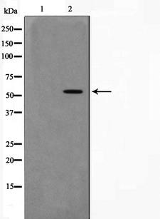 AKT1 Antibody - Western blot analysis on 293 cell lysates using AKT1 antibody. The lane on the left is treated with the antigen-specific peptide.