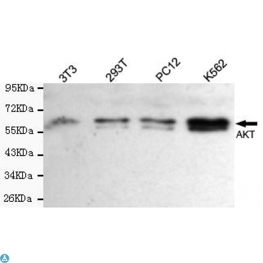 AKT1 Antibody - Western blot detection of total AKT in rat heart, rat testis, mouse brain, mouse spleen and C6 cell lysates and using AKT (pan) mouse mAb (1:1000 diluted). Predicted band size: 60KDa. Observed band size: 60KDa.