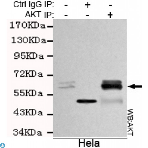 AKT1 Antibody - Immunoprecipitation analysis of Hela cell lysates using AKT (pan) mouse mAb.