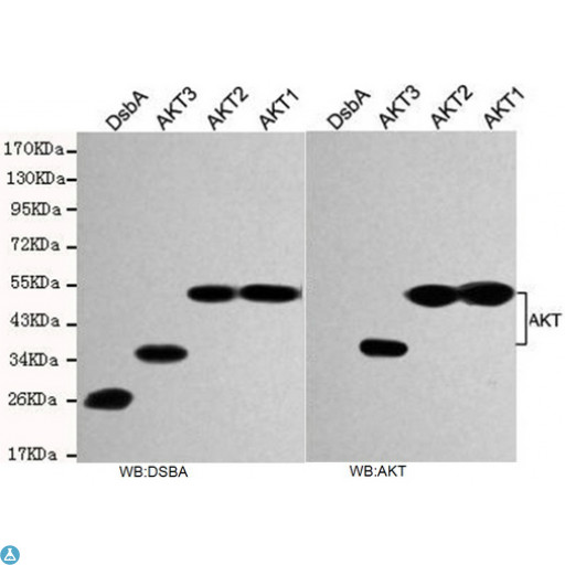 AKT1 Antibody - L:Western blot detection of DSBA in AKT1,AKT2,AKT3 and DSBA recombinant antigen fragments the same sample quality,and using DSBA mouse mAb (1:1000 diluted).R:Western blot detection of AKT in AKT1,AKT2 and AKT3 recombinant antigen fragments and using AKT (pan) mouse mAb (1:1000 diluted).