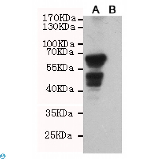 AKT1 Antibody - Western blot detection of AKT1 in CHO-K1 cell lysate (B) and CHO-K1 transfected by AKT1 (A) cell lysate using AKT1 mouse mAb (1:1000 diluted). Predicted band size: 60KDa. Observed band size: 60KDa.