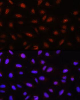AKT1 Antibody - Immunofluorescence analysis of U-2OS cells using Pan-AKT Polyclonal Antibody at dilution of 1:100.Blue: DAPI for nuclear staining.