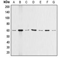 AKT1 Antibody - Western blot analysis of AKT expression in HeLa (A); A549 (B); Raw264.7 (C); NIH3T3 (D); mouse lung (E); PC12 (F); rat heart (G) whole cell lysates.